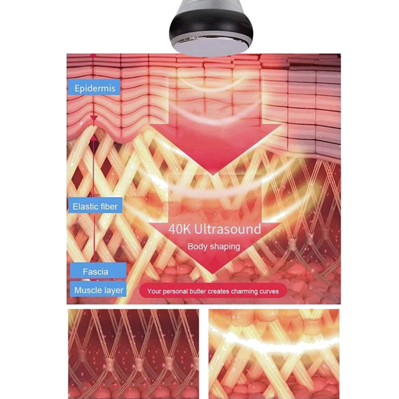 6-in-1 Ultrasonic Cavitation + RF Machine BioHealing®