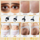 40K Cavitation & RF Fat Reduction device shown with four metal treatment probes and before-and-after skin and body comparisons