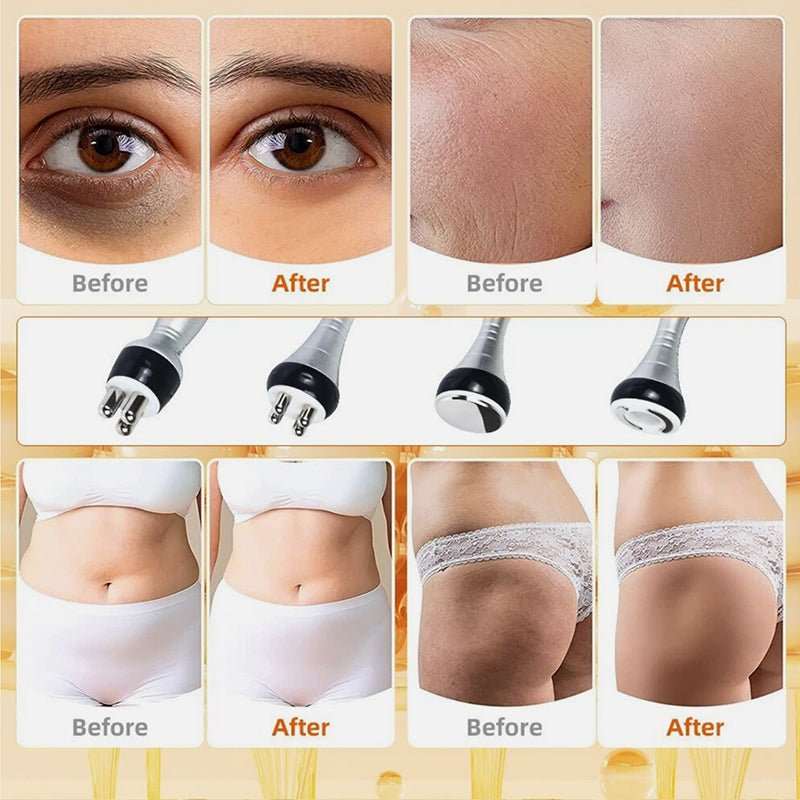 40K Cavitation & RF Fat Reduction device shown with four metal treatment probes and before-and-after skin and body comparisons
