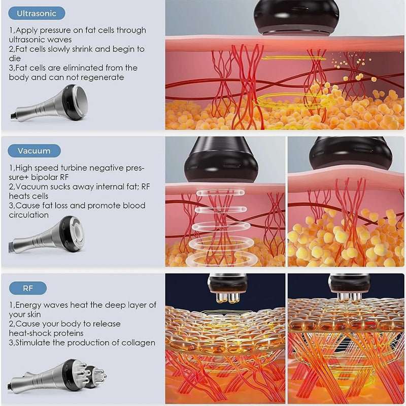 40K Cavitation & RF Fat Reduction handpiece diagram showing ultrasonic, vacuum and RF probes with skin tissue illustrations