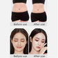 6-in-1 Ultrasonic Cavitation + RF Machine BioHealing®